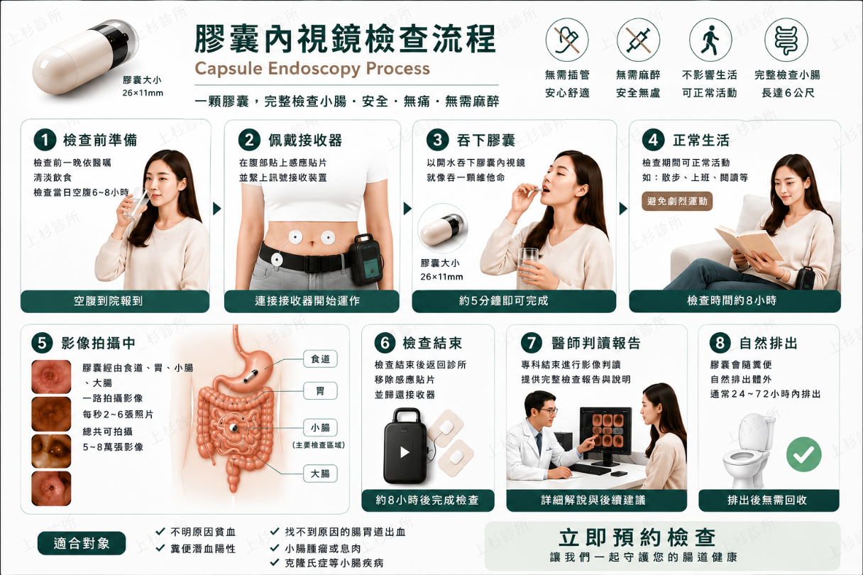上杉診所膠囊內視鏡小腸檢查流程