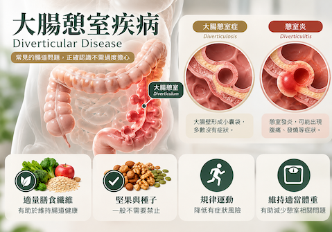 大腸憩室是什麼？憩室炎症狀、飲食與治療一次看懂